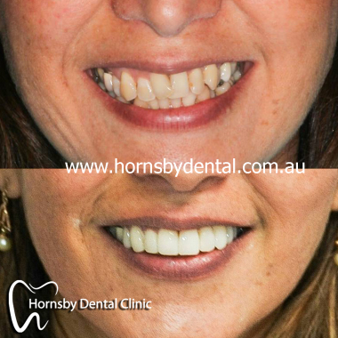 Hornsby_cosmetic_dentistry.jpg