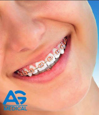 Brackets en León, Gto. 