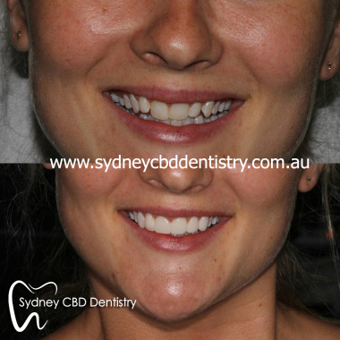 Cosmetic_dentisty_Sydney.jpg