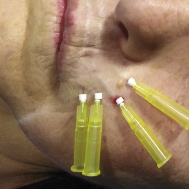Cirujano Dentista