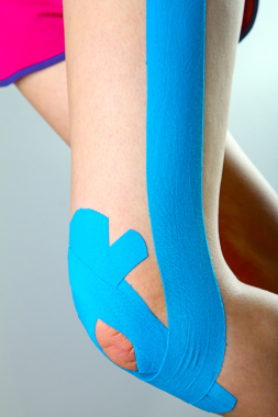Kinesiotaping