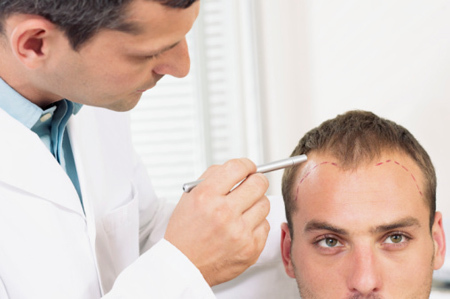BALDNESS TREATMENT