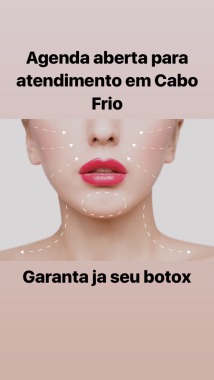 Garanta já seu botox