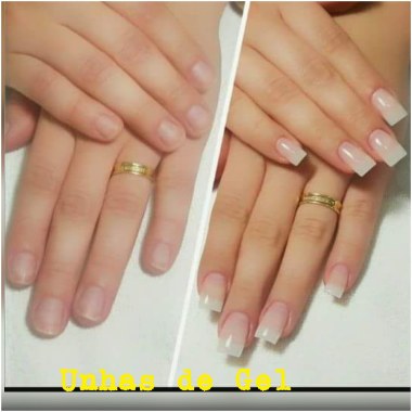 Antes e depois unhas de Gel