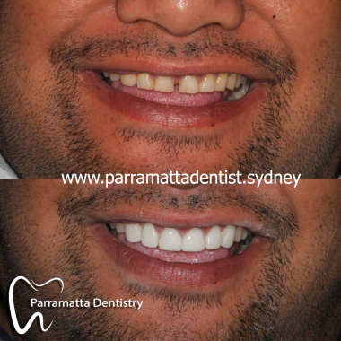 Cosmetic_dentistry.jpg