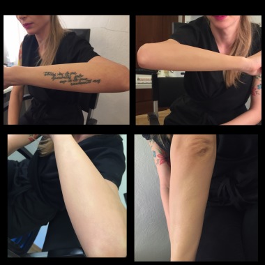 Copertura tatuagg