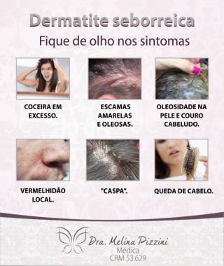 Dermatite seborreica tem controle!!! Converse com seu dermatologista.