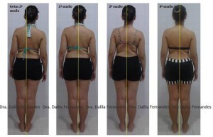 Reeducação Postural Global - Método de tratamento para resolução de dor e desconforto.