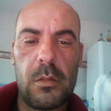 Reformas Rojas