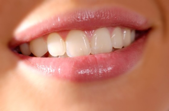 un beau sourire avec des belles dents blanche est comme une carte de visite