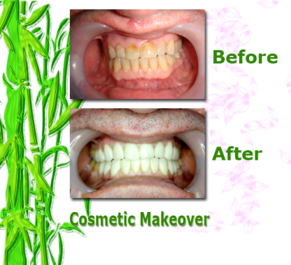 Cosmetic Makeover