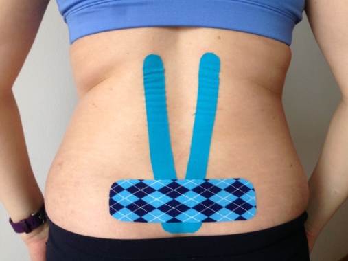 Kinesiotaping