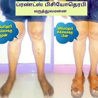 Friends Physiotherapy Hospital
