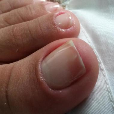 Manicure