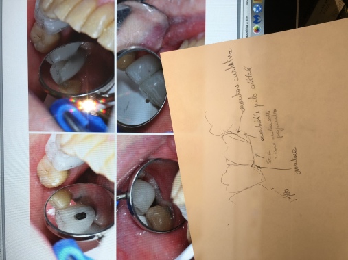 Tecnologie all’avanguardia Cad-Cam per le capsule. 
