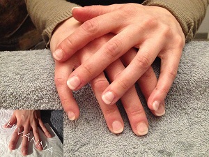 Reconstruction d'ongles