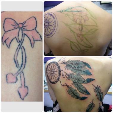 Tattoo Laser removalfor cover up