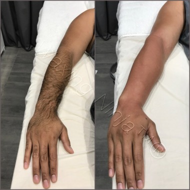 Mens full arm wax @Waxing Ninja