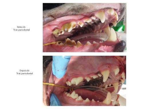 Tratamento Periodontal- antes e depois do tratamento
