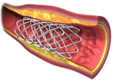 Grupo de Cardiologos en Guadalajara que realiza Cateterismo Cardiaco