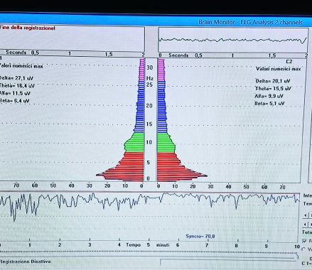 Biofeedback 