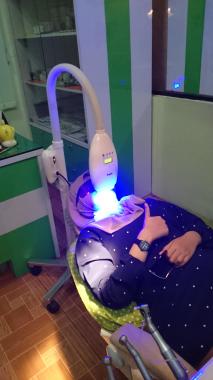 Pemutihan Gigi/Bleaching
