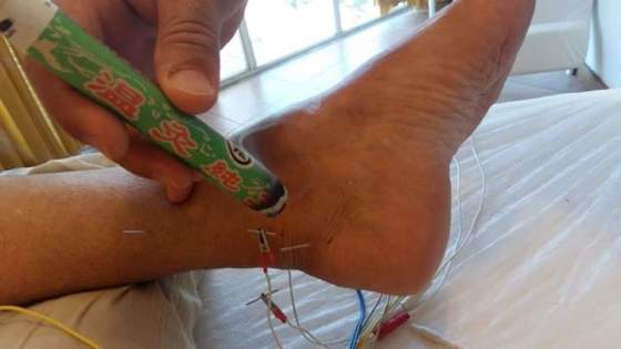 Maxa e eletro  tratamento dor e lesão no  tornozelo 