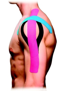 Aplicación de kinesiotape 