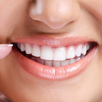 Soluciones Dentales Merida