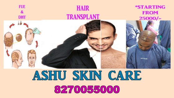 Hair Transplant surgeon 
