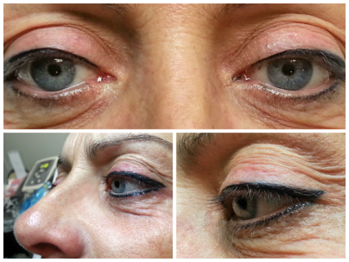 Eye liner permanent