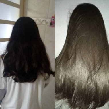 Botox sem formol