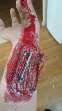 Latex sobre piel