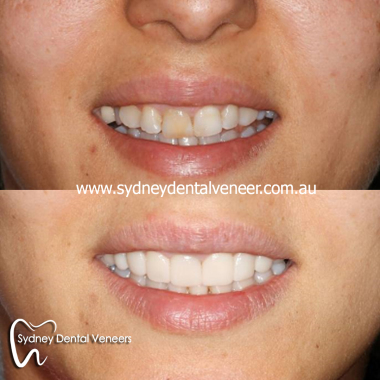 Sydney_Dental.jpg