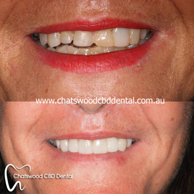 Chatswood_Dental_Care.jpg