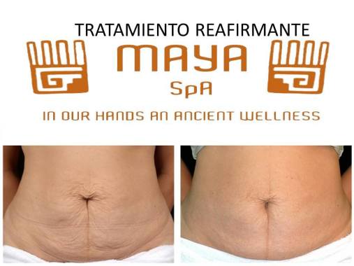 TRATAMIENTOS REAFIRMANTES