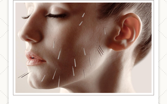Acupuntura Estética Facial