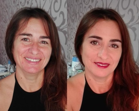 Antes e Depois