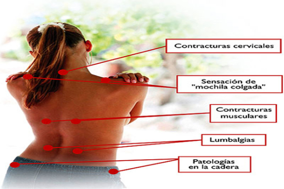 Dolor Muscular